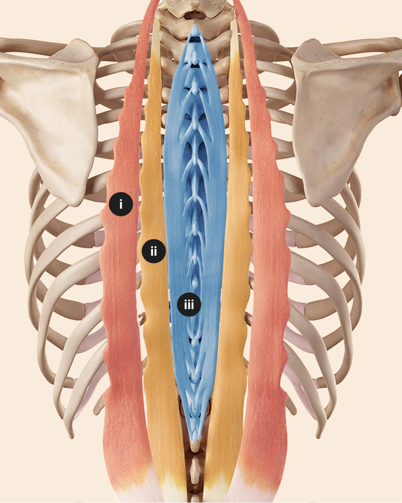 Die Abbildung zeigt die Untergruppen des Erector Spinae farbig hervorgehoben und mit i-iii markiert. rot: Iliocostalis (i), gelb: Longissimus (ii) und blau: Spinalis (iii). DIe Muskeln sind auf dem Rückenskelett an ihren jeweiligen Positionen abgebildet vor beigem Hintergrund.